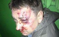В Сумах неизвестные жестоко избили одного из организаторов местного Майдана
