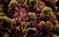 У коронавируса обнаружена способность влиять на клетки крови, - ученые