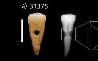 В Турции найдены древние украшения из человеческих зубов