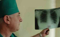 11% от общей численности больных туберкулезом в Европе - украинцы